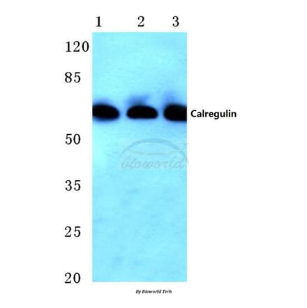 Anti-Calregulin (G54) Antibody from Bioworld Technology (BS2264) - Antibodies.com