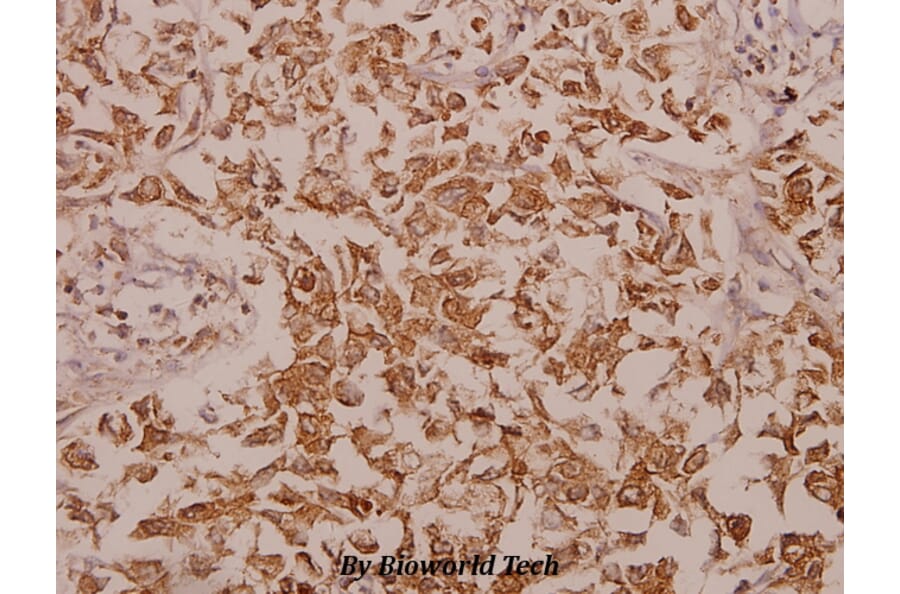 Anti-Calregulin (G54) Antibody from Bioworld Technology (BS2264) - Antibodies.com