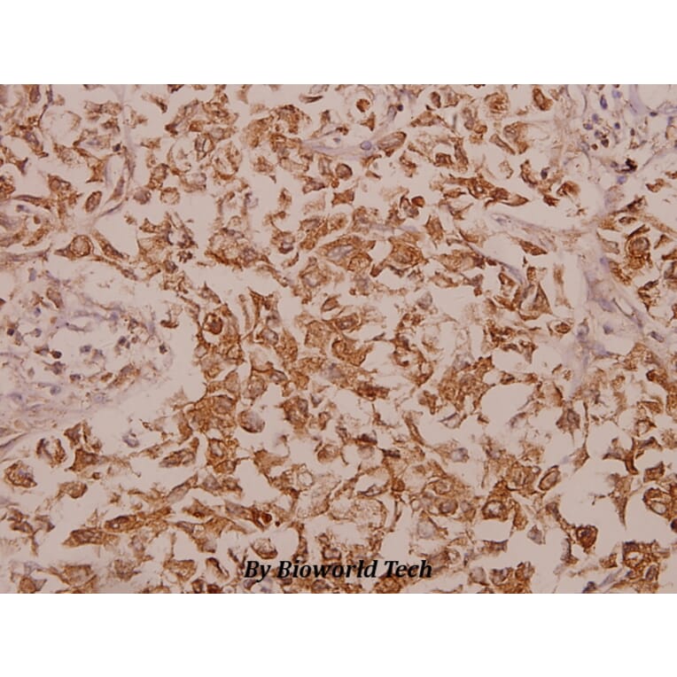 Anti-Calregulin (G54) Antibody from Bioworld Technology (BS2264) - Antibodies.com