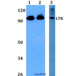 Anti-LTK (R241) Antibody from Bioworld Technology (BS2267) - Antibodies.com