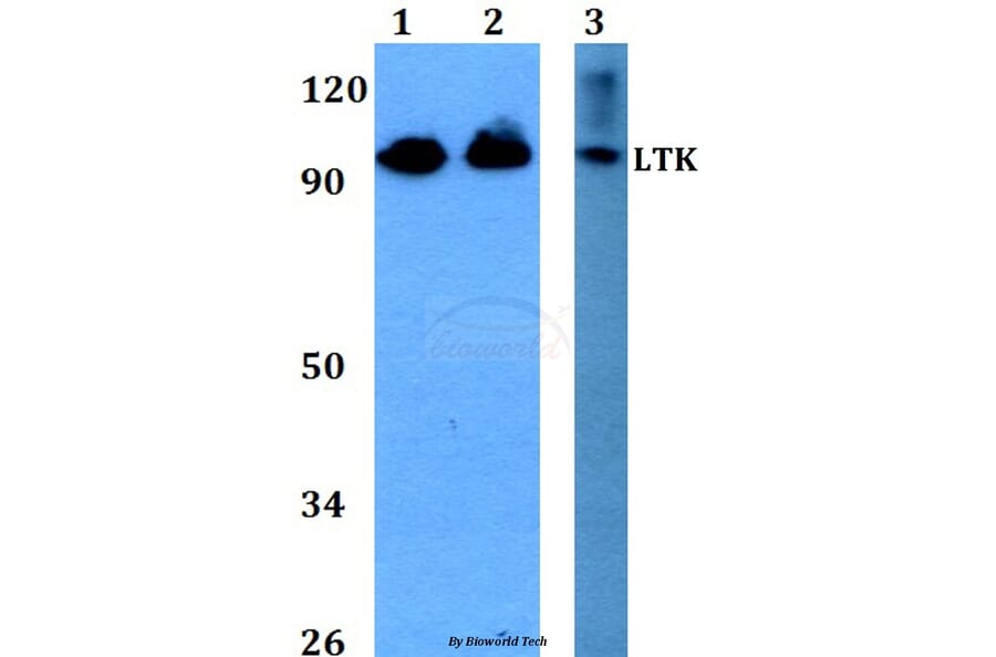 Anti-LTK (R241) Antibody from Bioworld Technology (BS2267) - Antibodies.com