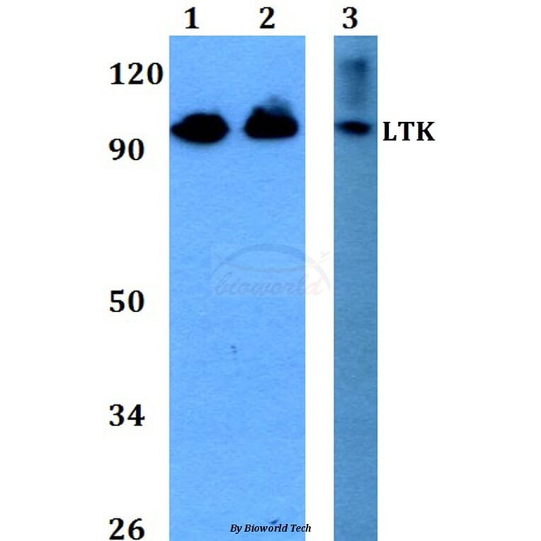 Anti-LTK (R241) Antibody from Bioworld Technology (BS2267) - Antibodies.com