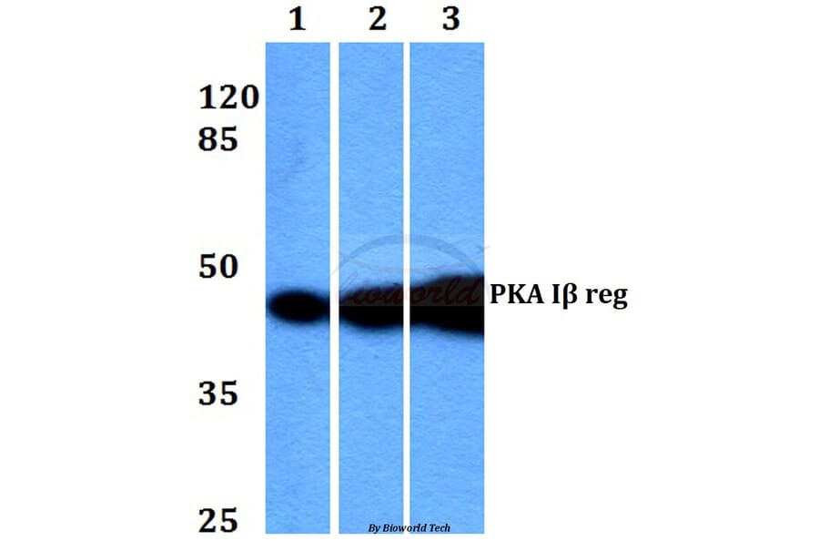Anti-PKA Iβ reg (F138) Antibody from Bioworld Technology (BS2269) - Antibodies.com
