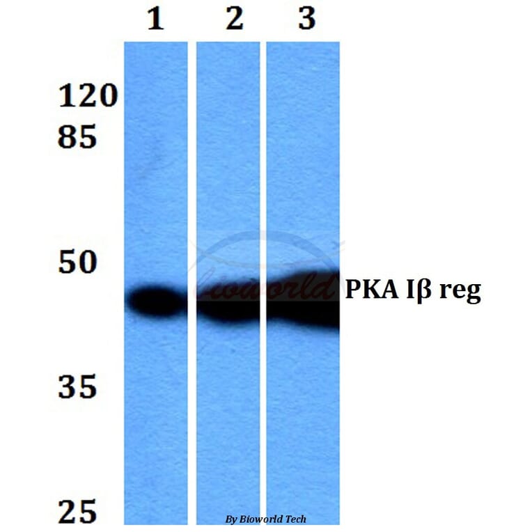 Anti-PKA Iβ reg (F138) Antibody from Bioworld Technology (BS2269) - Antibodies.com
