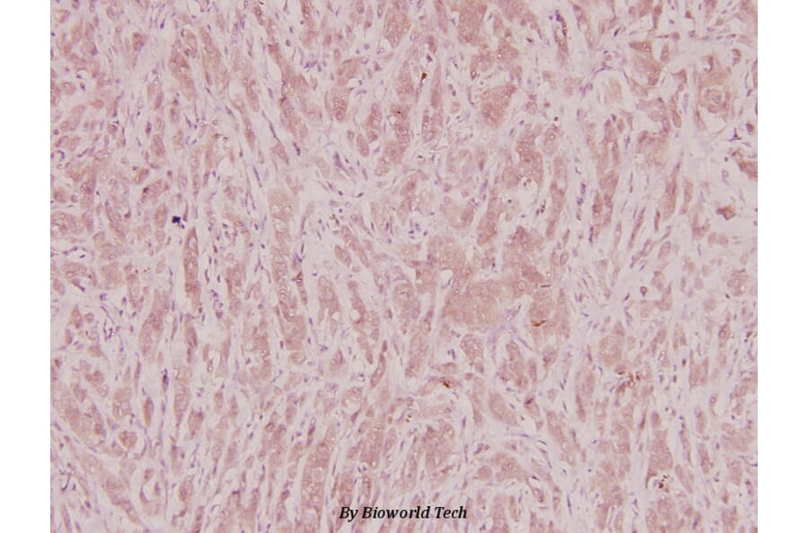 Anti-PKA Iβ reg (F138) Antibody from Bioworld Technology (BS2269) - Antibodies.com