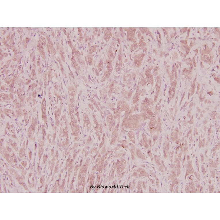 Anti-PKA Iβ reg (F138) Antibody from Bioworld Technology (BS2269) - Antibodies.com