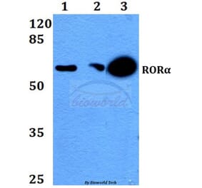 Anti-RORα (G41) Antibody from Bioworld Technology (BS2272) - Antibodies.com