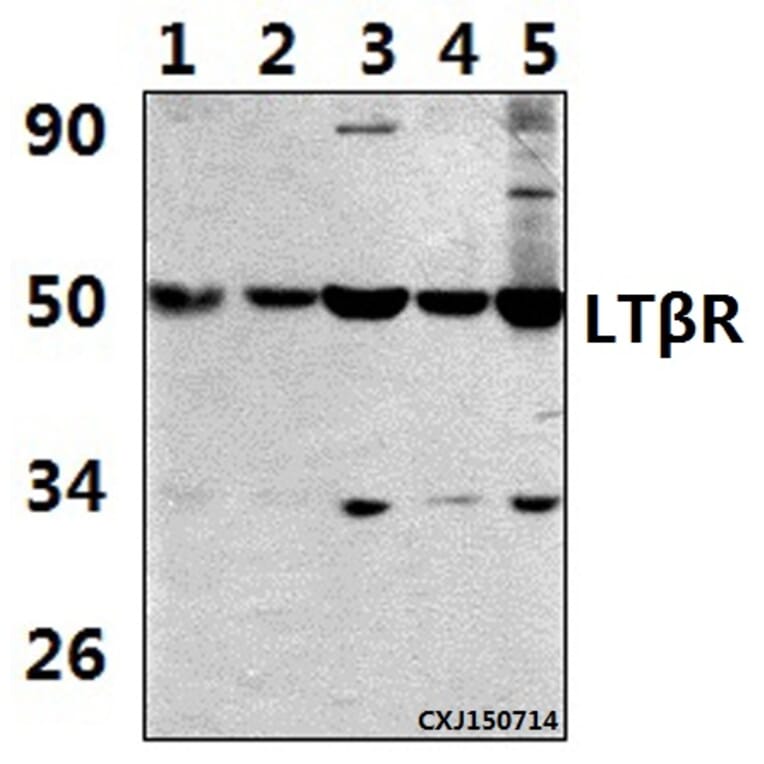Anti-LTβR (R44) Antibody from Bioworld Technology (BS2273) - Antibodies.com