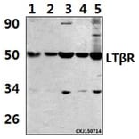 Anti-LTβR (R44) Antibody from Bioworld Technology (BS2273) - Antibodies.com