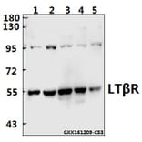 Anti-LTβR (R44) Antibody from Bioworld Technology (BS2273) - Antibodies.com