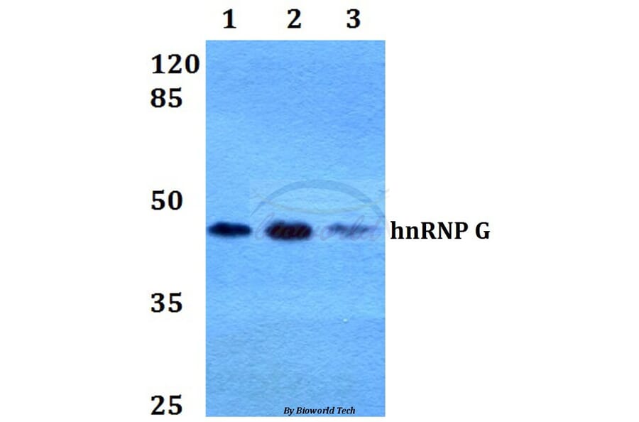 Anti-hnRNP G (M40) Antibody from Bioworld Technology (BS2274) - Antibodies.com