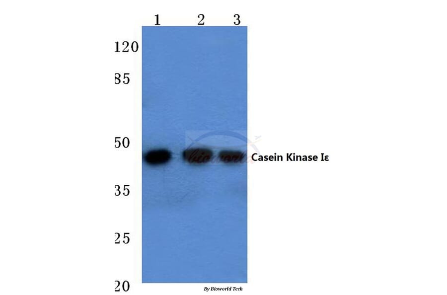 Anti-Casein Kinase Iε (P301) Antibody from Bioworld Technology (BS2279) - Antibodies.com