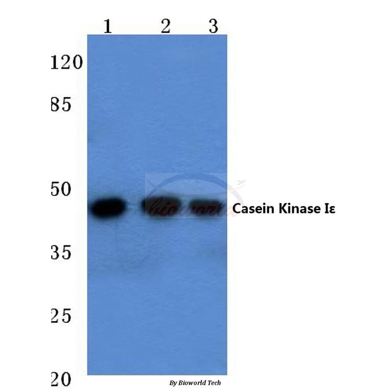 Anti-Casein Kinase Iε (P301) Antibody from Bioworld Technology (BS2279) - Antibodies.com
