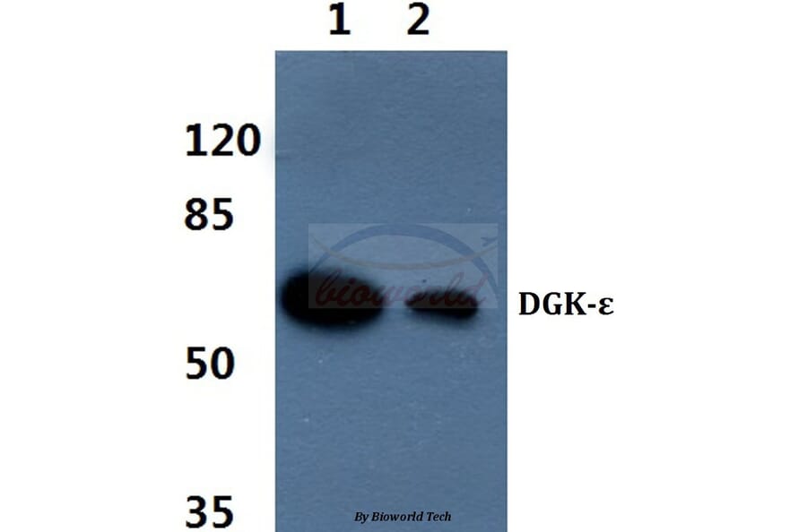Anti-DGK-ε (S194) Antibody from Bioworld Technology (BS2281) - Antibodies.com