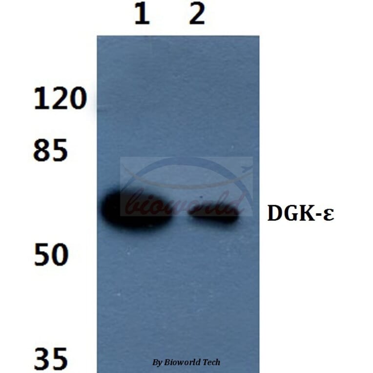 Anti-DGK-ε (S194) Antibody from Bioworld Technology (BS2281) - Antibodies.com