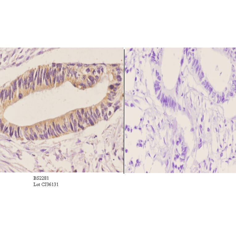Anti-DGK-ε (S194) Antibody from Bioworld Technology (BS2281) - Antibodies.com