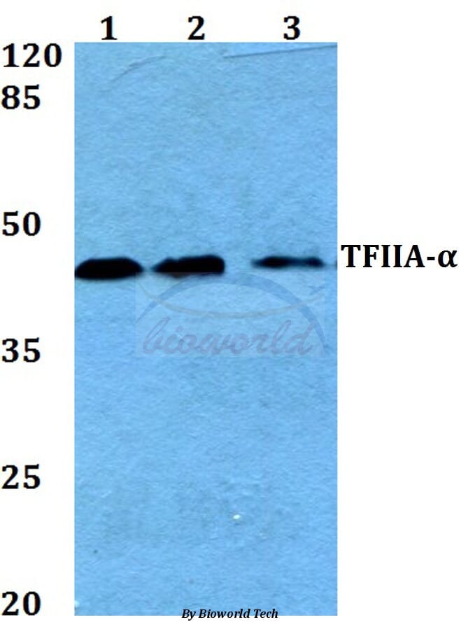 Anti-TFIIA-α (E311) Antibody (A26173) | Antibodies.com