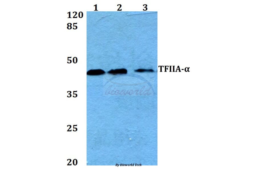 Anti-TFIIA-α (E311) Antibody from Bioworld Technology (BS2282) - Antibodies.com