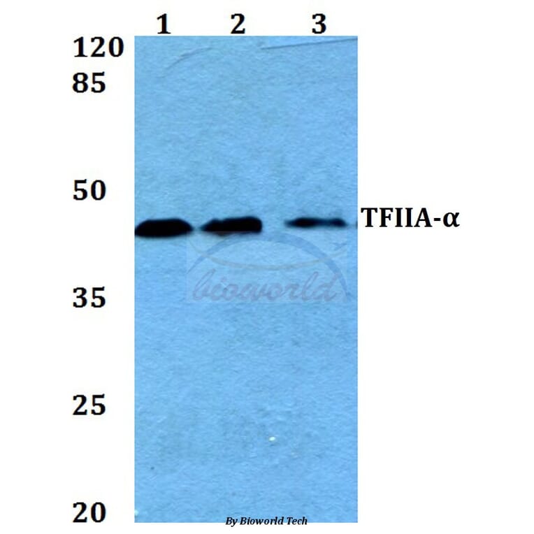 Anti-TFIIA-α (E311) Antibody from Bioworld Technology (BS2282) - Antibodies.com