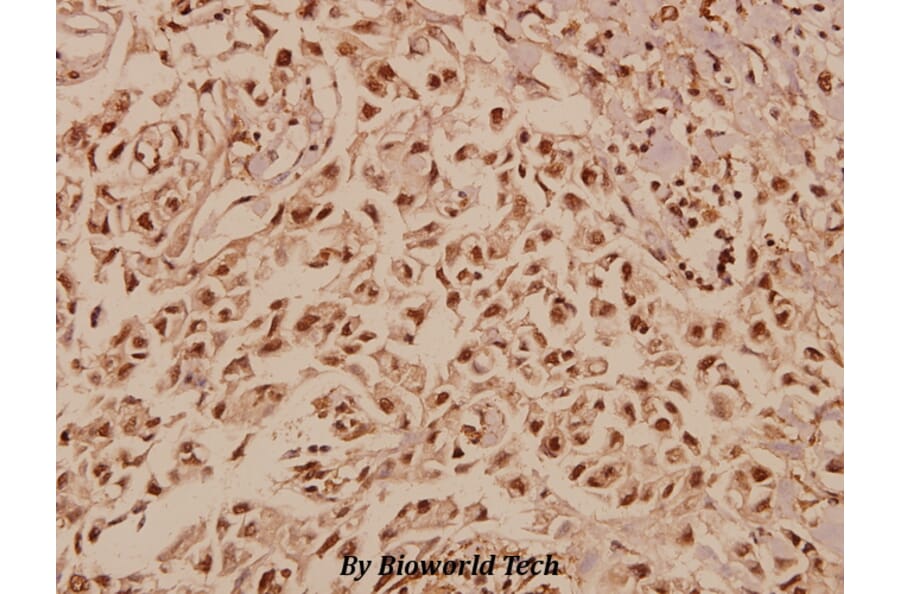 Anti-TFIIA-α (E311) Antibody from Bioworld Technology (BS2282) - Antibodies.com
