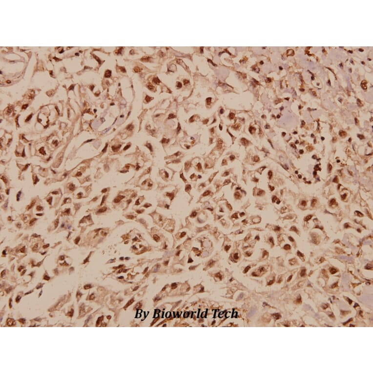 Anti-TFIIA-α (E311) Antibody from Bioworld Technology (BS2282) - Antibodies.com