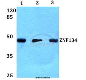 Anti-ZNF134 (K72) Antibody from Bioworld Technology (BS2283) - Antibodies.com