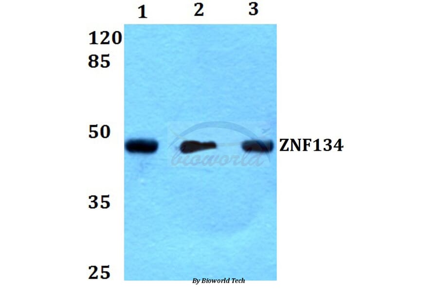 Anti-ZNF134 (K72) Antibody from Bioworld Technology (BS2283) - Antibodies.com