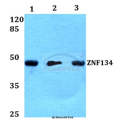 Anti-ZNF134 (K72) Antibody from Bioworld Technology (BS2283) - Antibodies.com