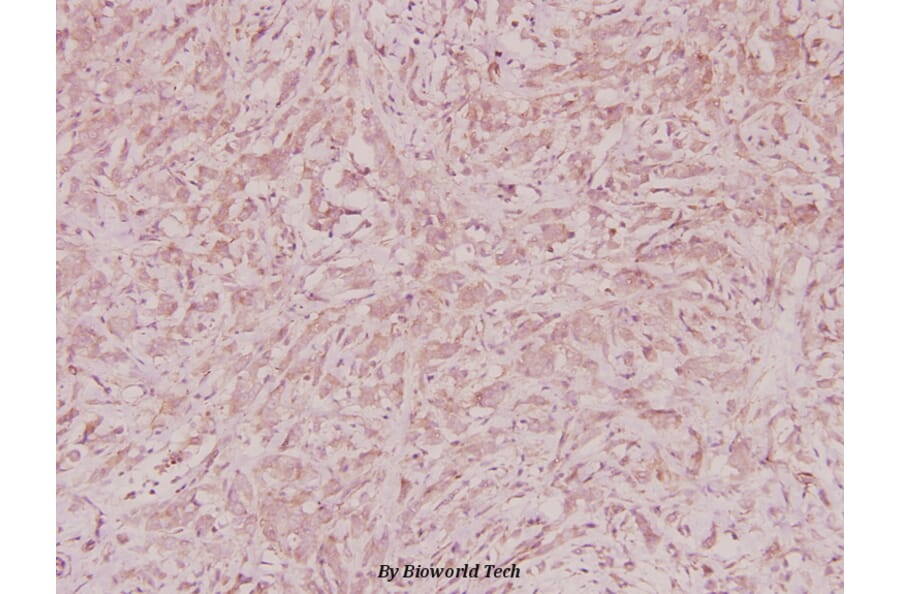 Anti-ZNF134 (K72) Antibody from Bioworld Technology (BS2283) - Antibodies.com