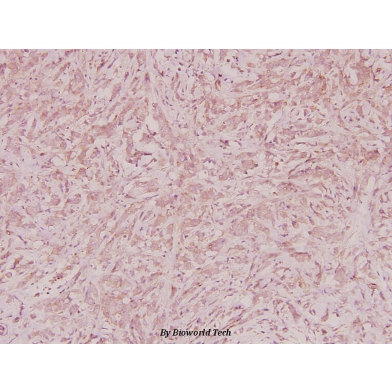 Anti-ZNF134 (K72) Antibody from Bioworld Technology (BS2283) - Antibodies.com