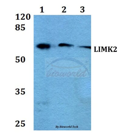 Anti-LIMK2 (K491) Antibody from Bioworld Technology (BS2284) - Antibodies.com