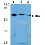 Anti-LIMK2 (K491) Antibody from Bioworld Technology (BS2284) - Antibodies.com