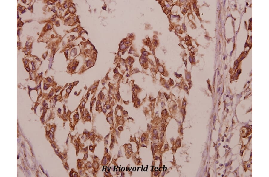 Anti-PBF (R151) Antibody from Bioworld Technology (BS2285) - Antibodies.com