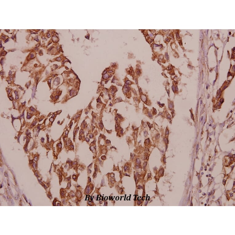 Anti-PBF (R151) Antibody from Bioworld Technology (BS2285) - Antibodies.com