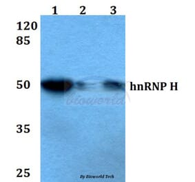 Anti-hnRNP H (R192) Antibody from Bioworld Technology (BS2286) - Antibodies.com