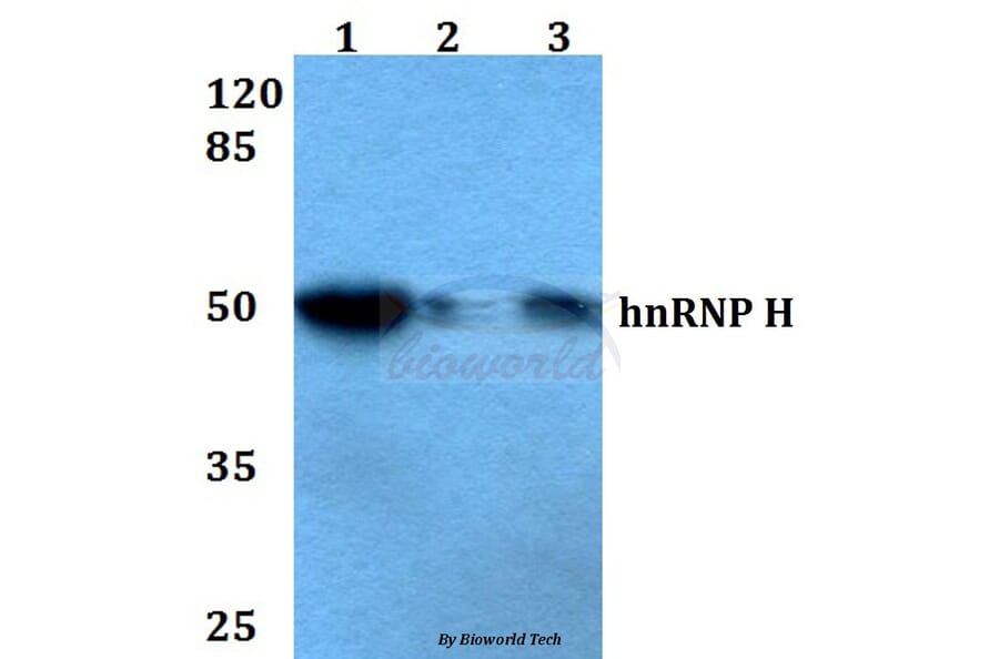Anti-hnRNP H (R192) Antibody from Bioworld Technology (BS2286) - Antibodies.com