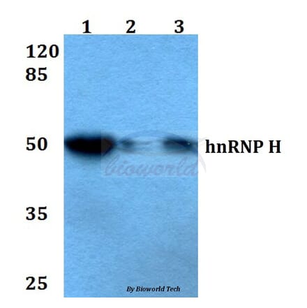 Anti-hnRNP H (R192) Antibody from Bioworld Technology (BS2286) - Antibodies.com