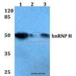 Anti-hnRNP H (R192) Antibody from Bioworld Technology (BS2286) - Antibodies.com