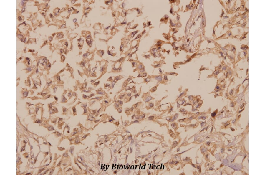 Anti-hnRNP H (R192) Antibody from Bioworld Technology (BS2286) - Antibodies.com