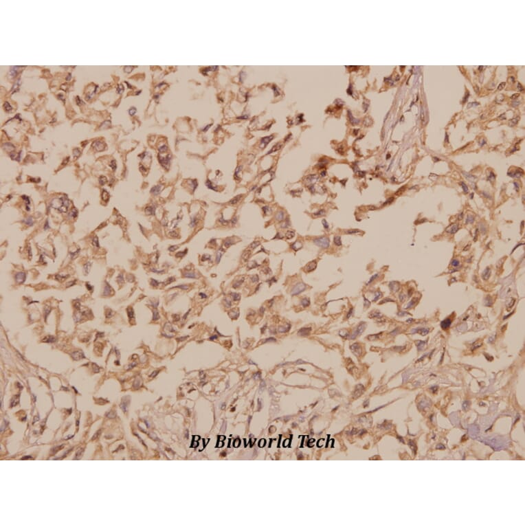 Anti-hnRNP H (R192) Antibody from Bioworld Technology (BS2286) - Antibodies.com