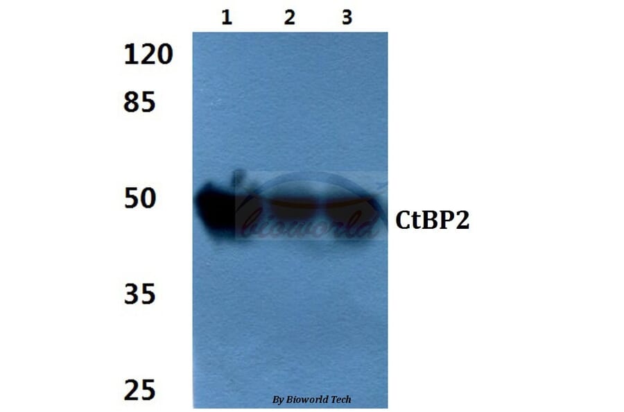 Anti-CtBP2 (P432) Antibody from Bioworld Technology (BS2287) - Antibodies.com
