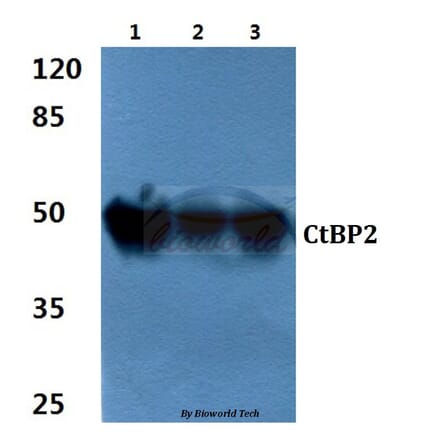 Anti-CtBP2 (P432) Antibody from Bioworld Technology (BS2287) - Antibodies.com