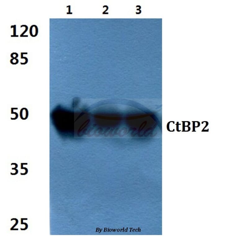 Anti-CtBP2 (P432) Antibody from Bioworld Technology (BS2287) - Antibodies.com