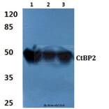 Anti-CtBP2 (P432) Antibody from Bioworld Technology (BS2287) - Antibodies.com