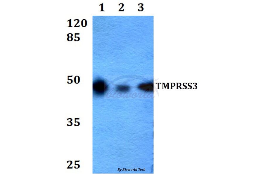 Anti-TMPRSS3 (F440) Antibody from Bioworld Technology (BS2289) - Antibodies.com