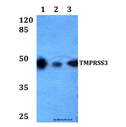 Anti-TMPRSS3 (F440) Antibody from Bioworld Technology (BS2289) - Antibodies.com