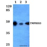 Anti-TMPRSS3 (F440) Antibody from Bioworld Technology (BS2289) - Antibodies.com