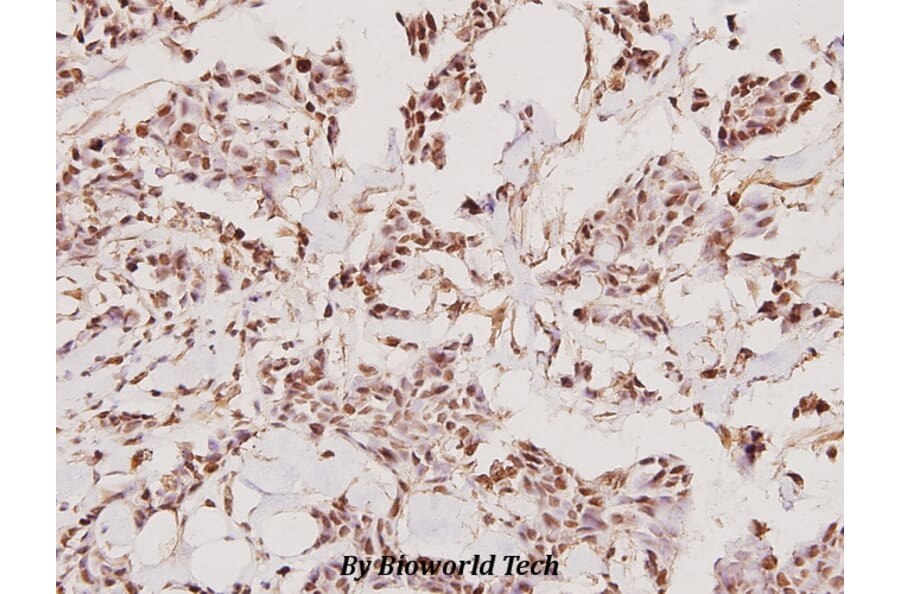 Anti-TMPRSS3 (F440) Antibody from Bioworld Technology (BS2289) - Antibodies.com