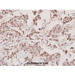 Anti-TMPRSS3 (F440) Antibody from Bioworld Technology (BS2289) - Antibodies.com