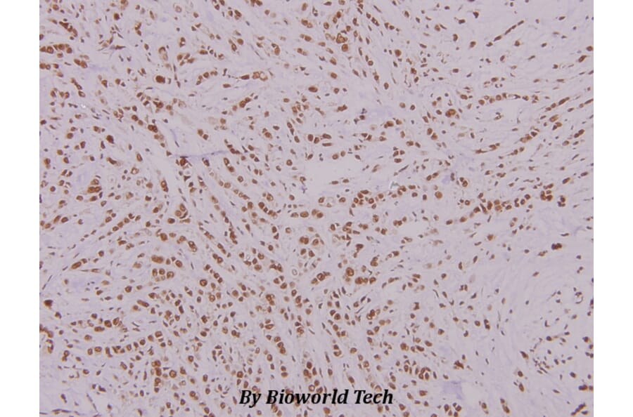 Anti-FoxK1 (G698) Antibody from Bioworld Technology (BS2293) - Antibodies.com